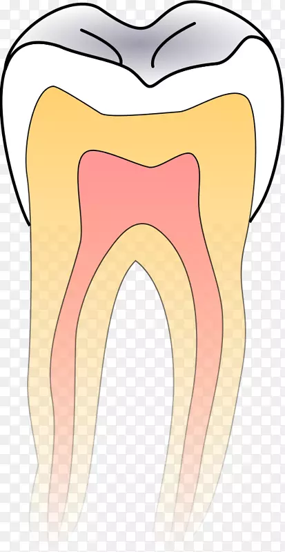 牙科蛀牙.牙科
