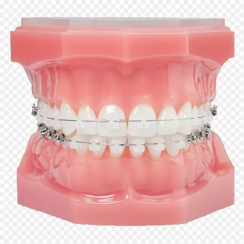牙科支架达蒙系统清晰的准齐器正畸自扎托槽支架