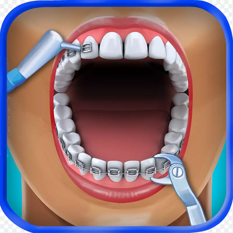 洗剂纹身牙医Amazon.com牙套