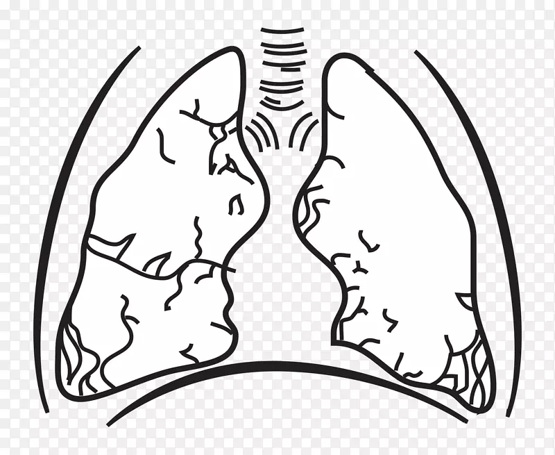 匈牙利大平原肺呼吸-肺