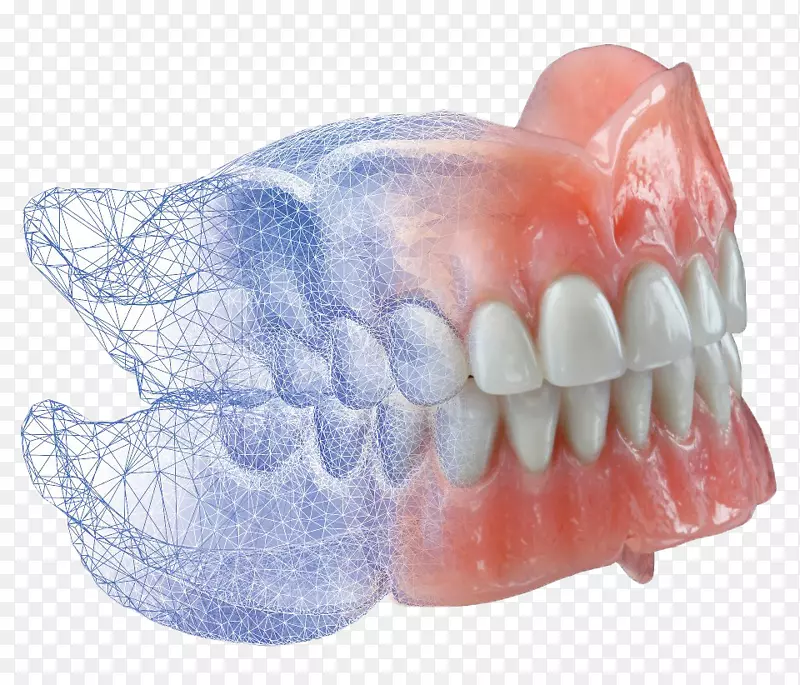 CAD/CAM牙科假牙-冠