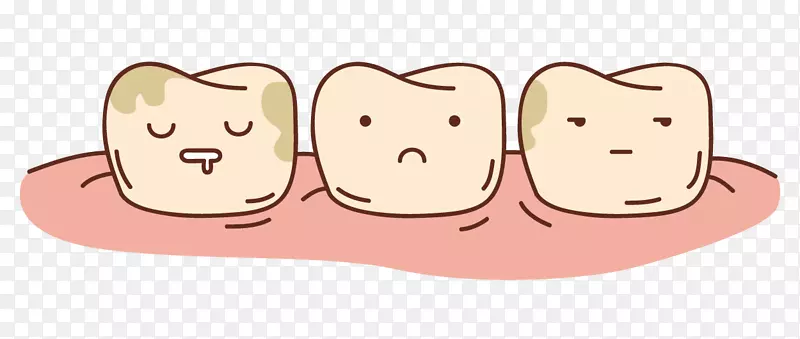 龋齿，牙本质过敏症，牙科学，牙齿病理学.牙齿
