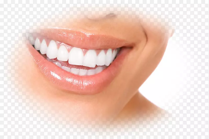 义齿、牙科牙龈、牙种植体-凹痕