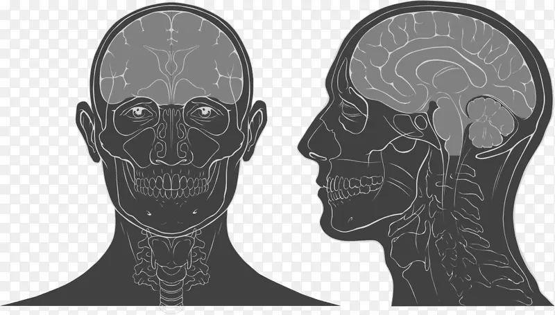 头颈解剖头盖骨脑解剖学