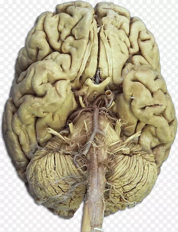 颅神经解剖学脑神经系统解剖学