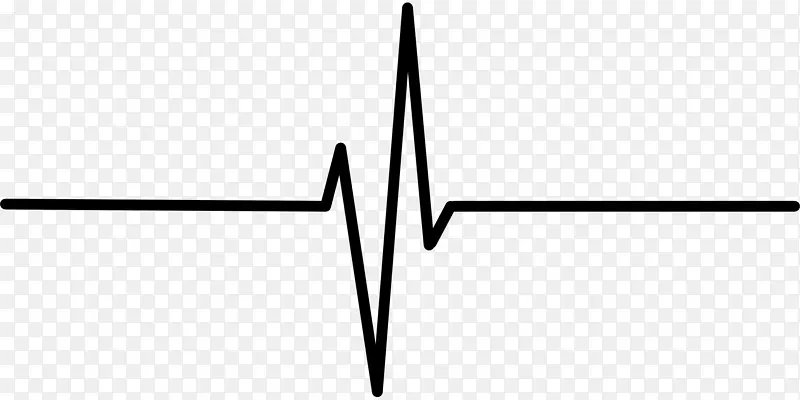 心率监测心电图脉搏心脏病发作