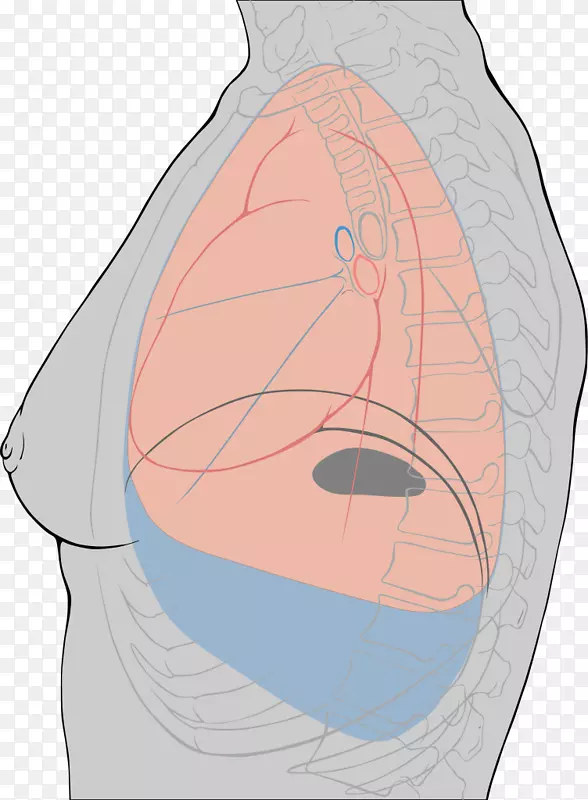 胸膜炎胸膜腔胸腔积液肺炎症标志