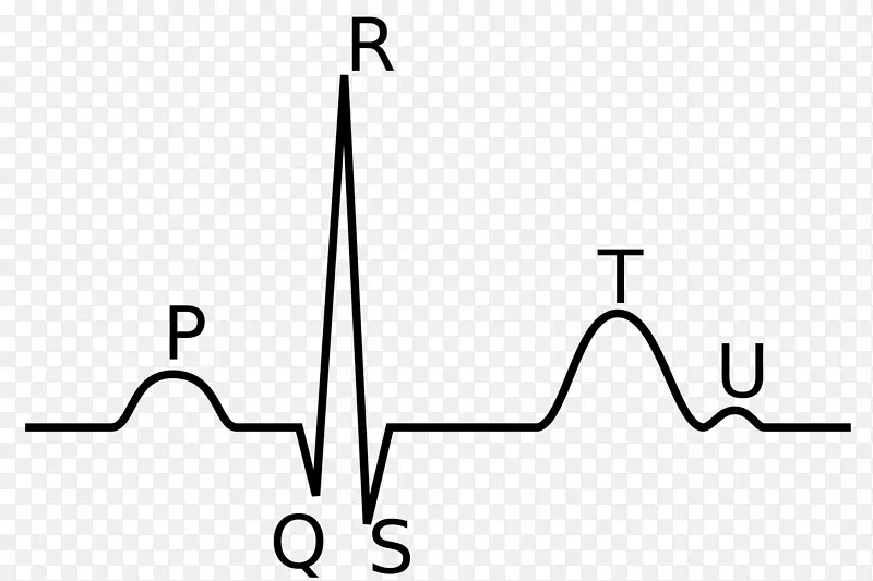 QRS复合心电图p波心脏去极化心电图