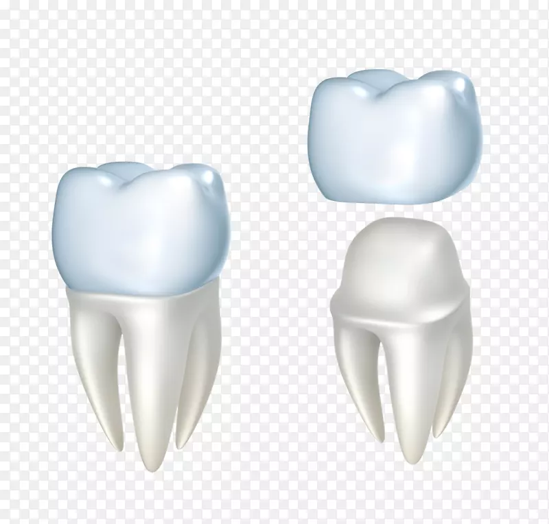 牙科修复桥-牙线