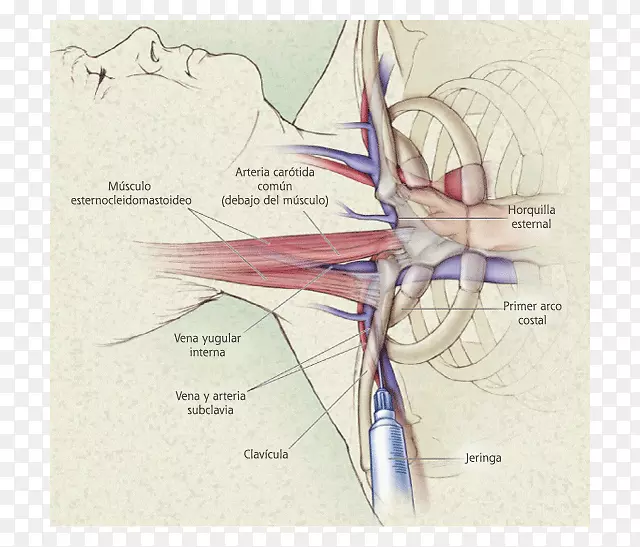 中心静脉导管中心静脉压锁骨下静脉-中央静脉