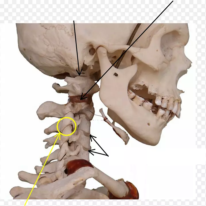 骨骨骼关节颌骨头骨韧带