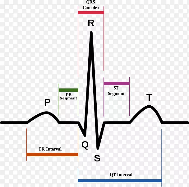 QT间期长qt综合征Pr间期t波QRs复合心电图