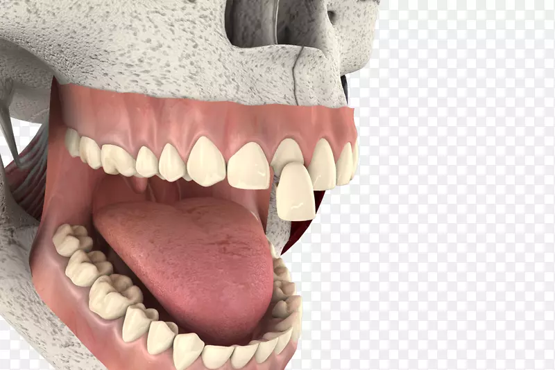 动画三维计算机图形电影制片业.三维牙齿