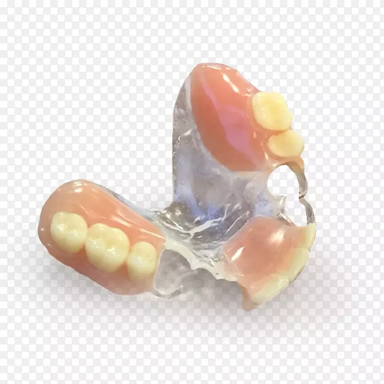 义齿牙科制造牙科印模.部分