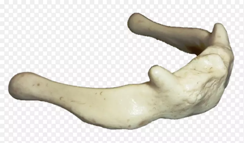 骨颌骨塑形指h&m-平面不规则形状