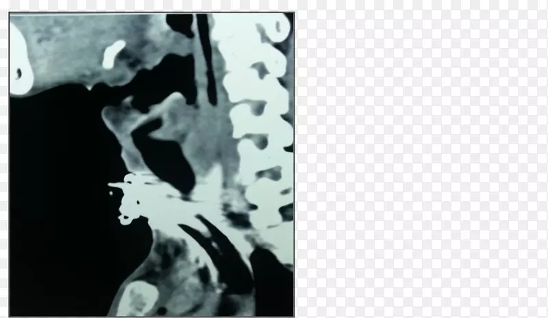 视觉艺术医学影像模板单色颈血迹