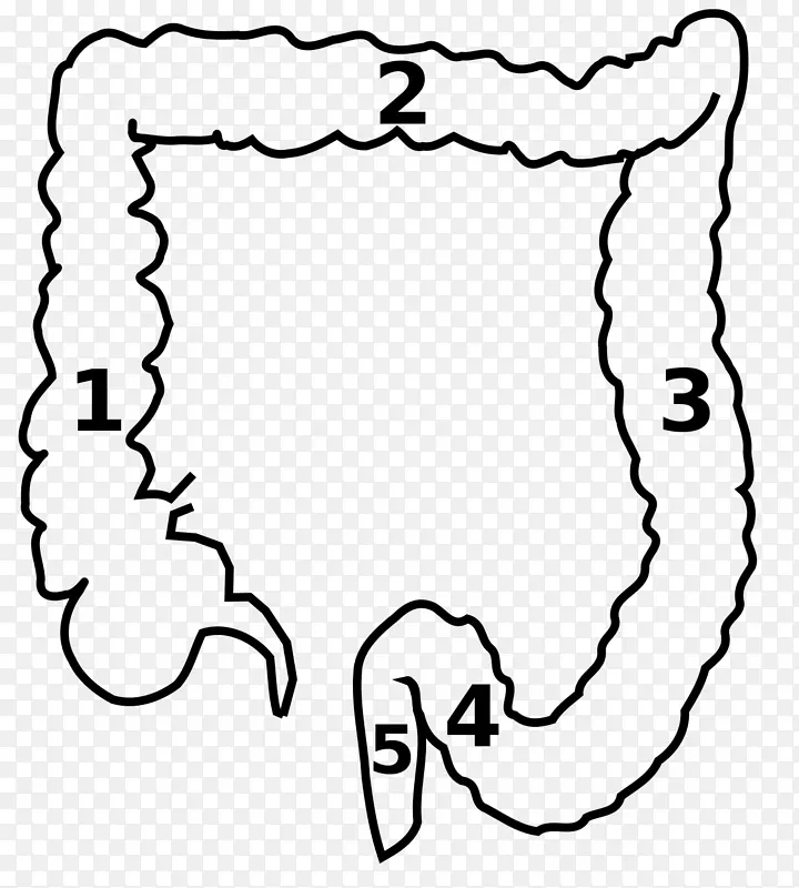 降结肠、大肠、横结肠、乙状结肠、升结肠