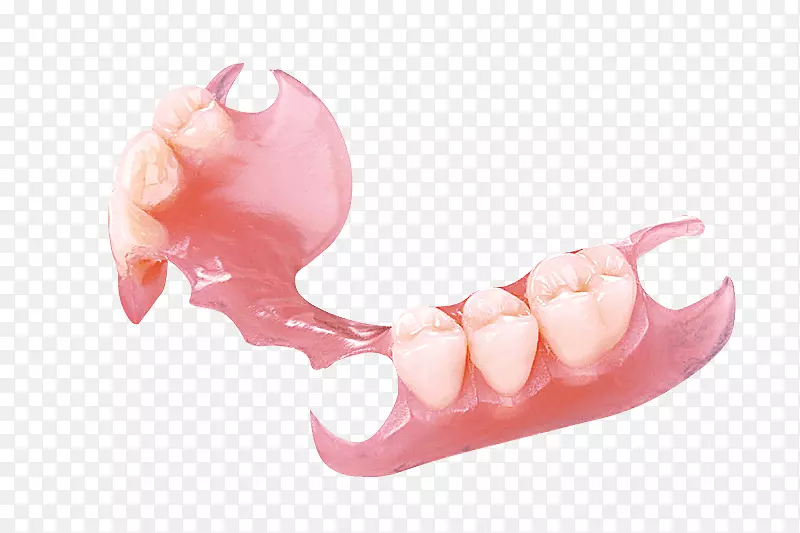 可摘局部义齿牙科冠