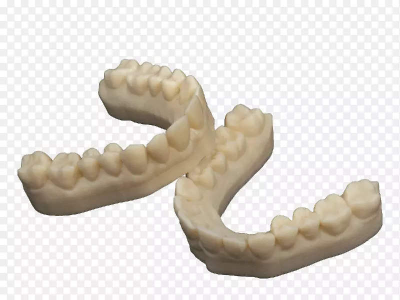 牙科复合冠三维打印.三维牙齿修复