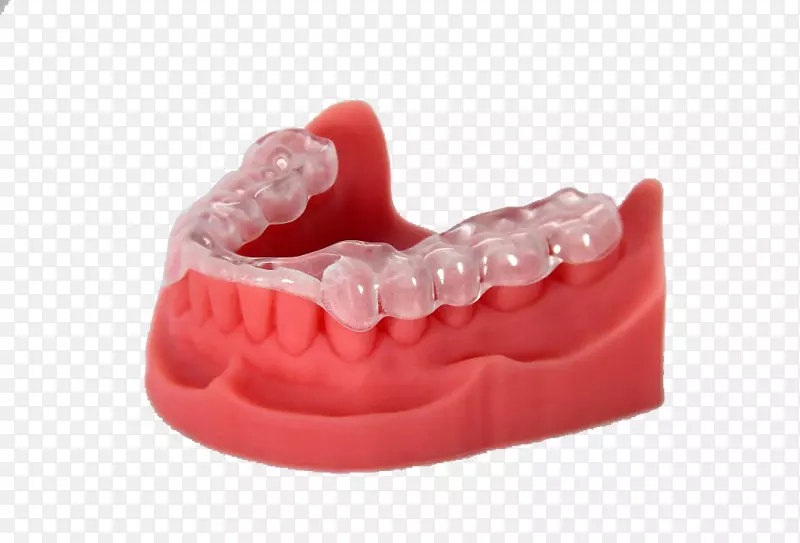 牙科3D打印.TEC打印机.蜡打印