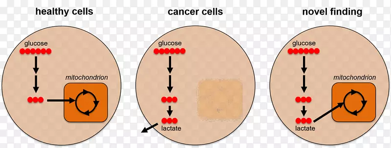 癌细胞代谢组学-可爱的癌细胞细节