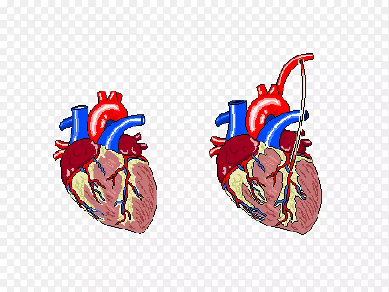 心率、心电图、心肌梗死-一捆气球