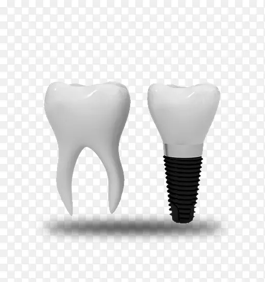 牙种植体牙科正畸学