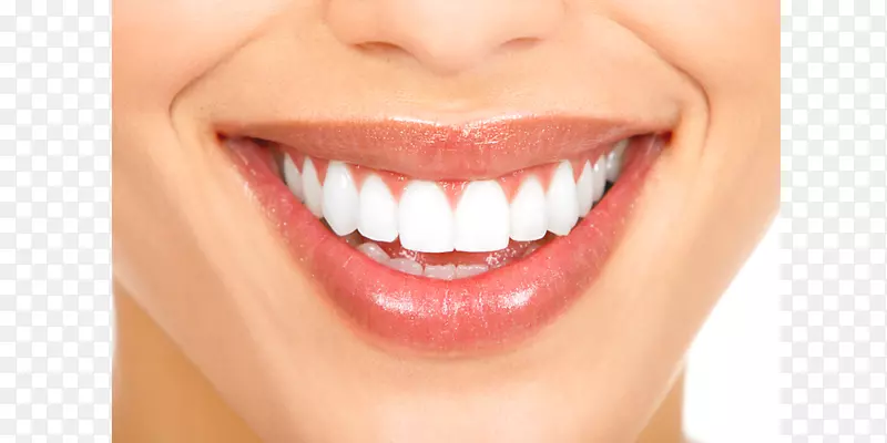 牙科美容微笑人类牙齿微笑