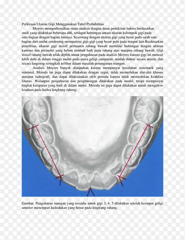 颌骨正畸概率医学牙科