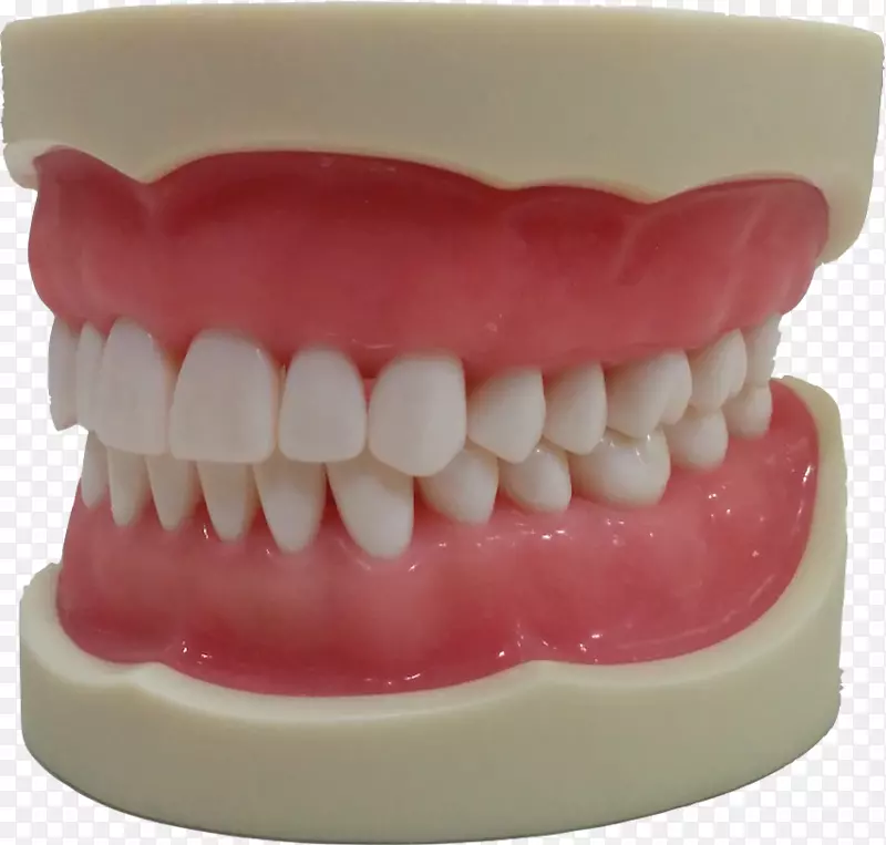 人牙颌骨型牙龈模型