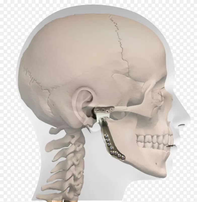 鼻标准解剖位置水平平面颞下颌关节解剖-牙齿模型