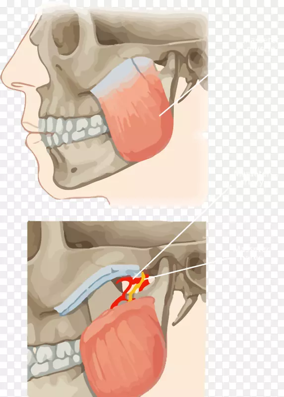咀嚼肌咬肌外侧翼肌颞下颌关节内侧翼肌形角