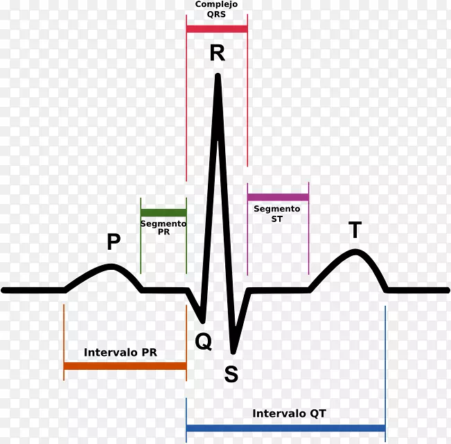 心电图QRs复杂窦性心律t波点三角形