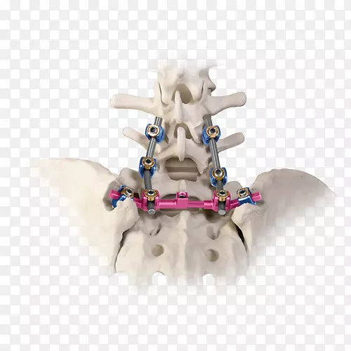 椎骶髂关节骨接合信息骶骨