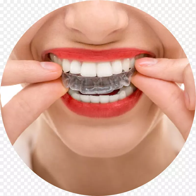 正畸学牙科牙床清晰对齐器腐朽牙