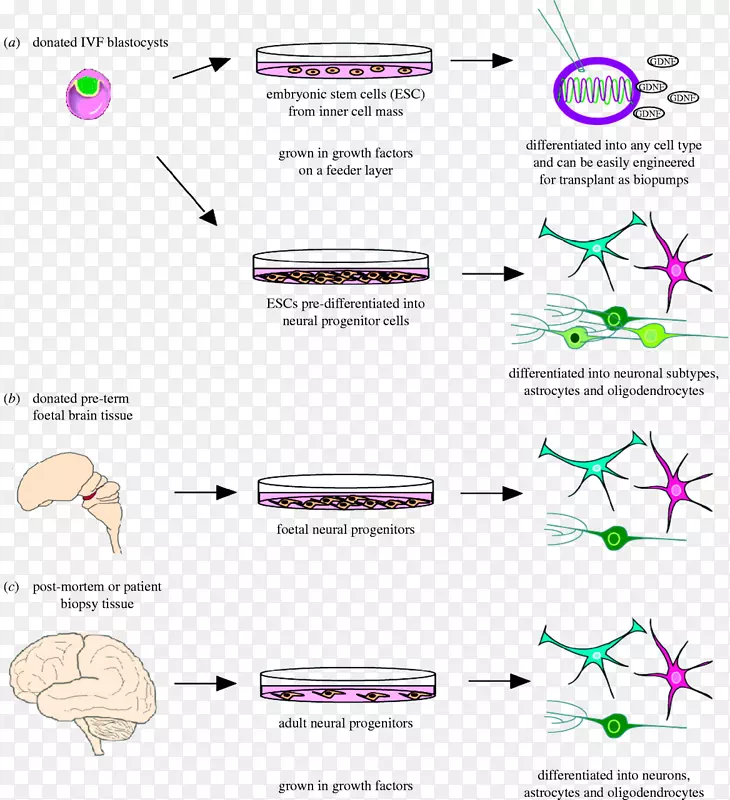神经变性干细胞治疗脑造血干细胞