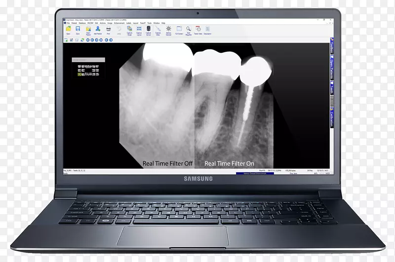 上网本膝上型电脑模拟屏幕截图-笔记本电脑显示器模型