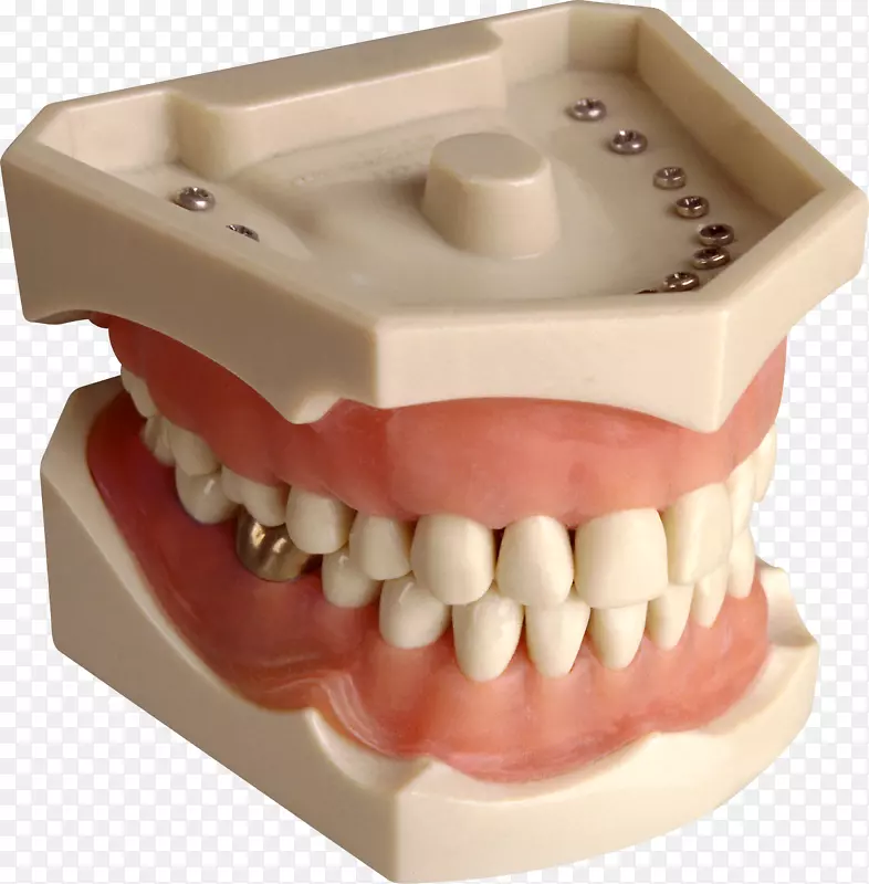 下颌上颌牙龈.钢牙