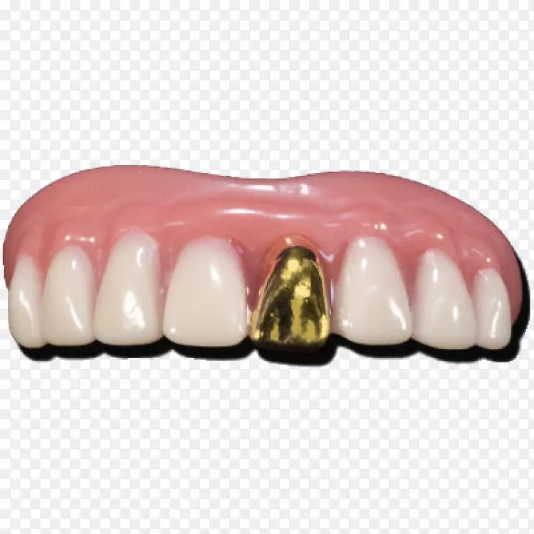人牙金牙义齿.金