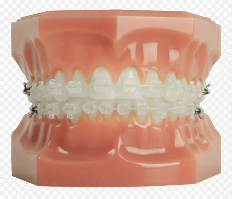 人类牙齿牙套清晰对齐牙科学.牙齿模型