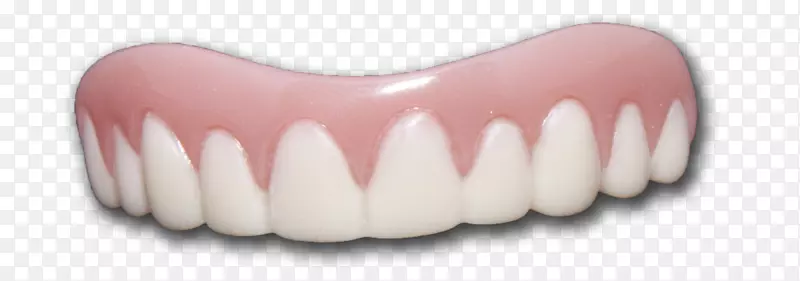 人牙齿贴面义齿.保护牙齿和牙齿的卡通