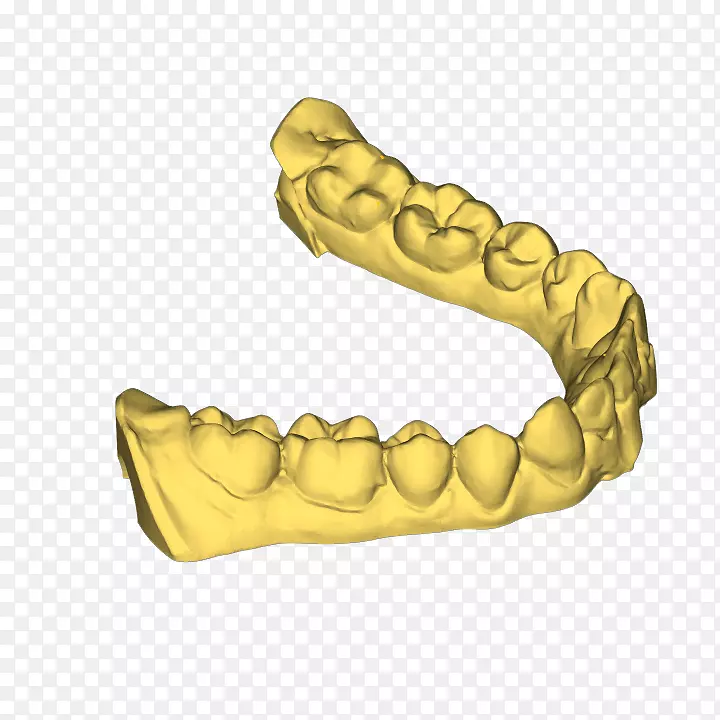 3D打印机牙弓牙科.牙痛的三维牙科治疗
