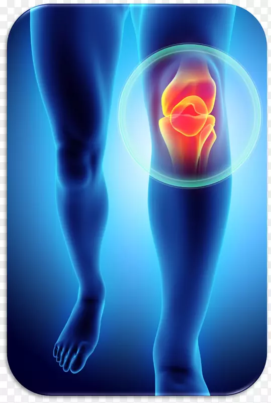 膝痛髌股痛综合征皱襞综合征损伤-膝关节骨