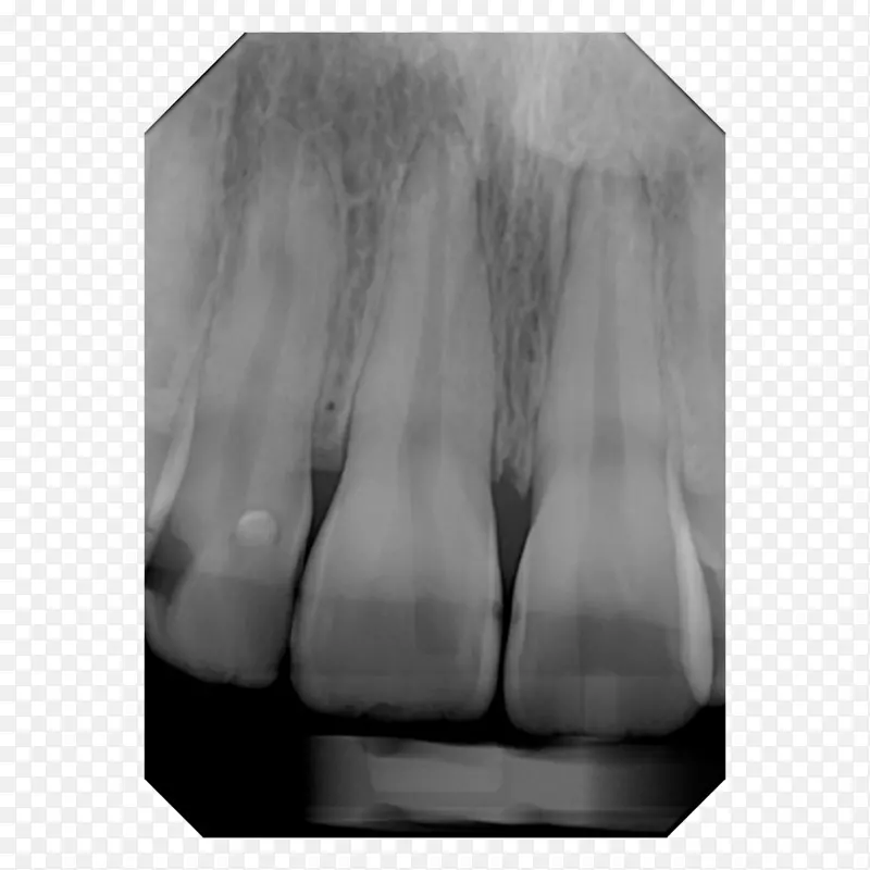 数字X射线牙科摄影锥束计算机断层扫描装置