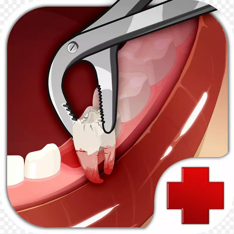 流行游戏“钻石”疯狂牙医办公室急诊室-牙医在线虚拟牙医医院-牙科外科游戏iphone-牙科镜