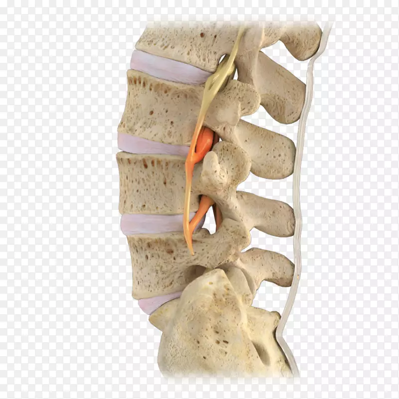 腰椎椎管狭窄，脊髓神经