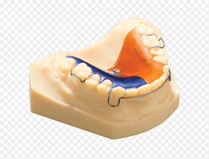 牙科技术.牙痛的三维牙科治疗