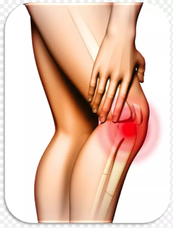膝痛治疗髂胫束综合征愈合-健康
