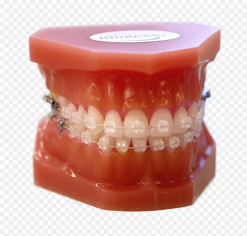 牙齿正畸，牙科，清楚的对齐器，保持器