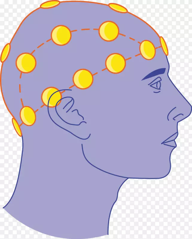 脑电描记医疗器械电极夹艺术脑
